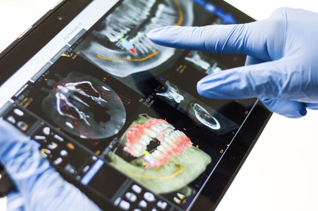 A dentist's gloved hand pointing at a dental scan displayed on a tablet screen.
